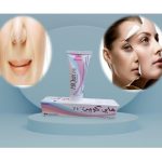 Hiquin Acne Treatment Cream