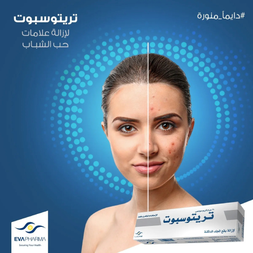 Tritospot Cream Removes Dark Spots From The Skin.