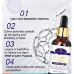 Anti Acne Whitening Facial Serum
